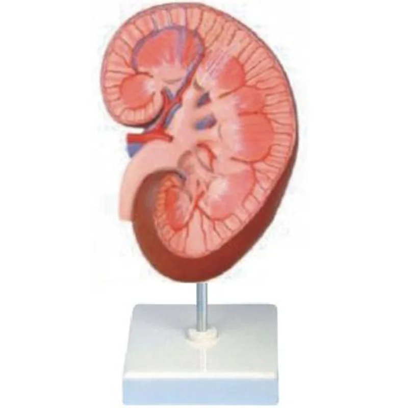 
			14005 Modelo de riñón		