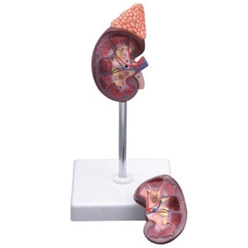 
			14006-2 Modelo de riñón con glándulas suprarrenales ARI Equipos médicos de alta calidad		