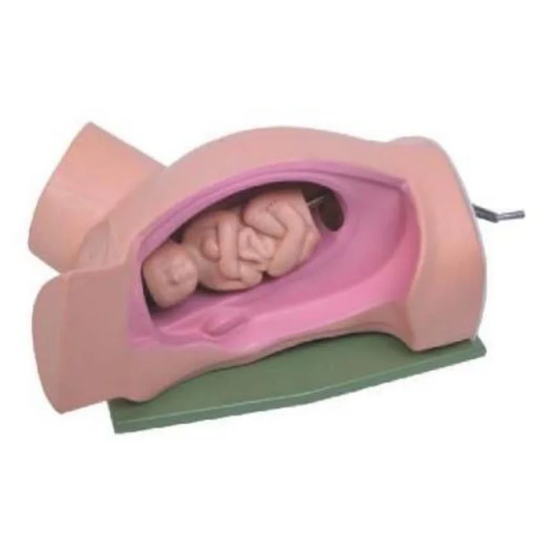 
			Modelo de las 5 maniobras de Leopold		