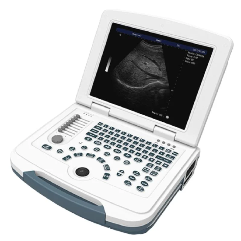 
			Escáner de ultrasonido totalmente digital portátil en blanco y negro AR-9000C ARI Equipos médicos de alta calidad		