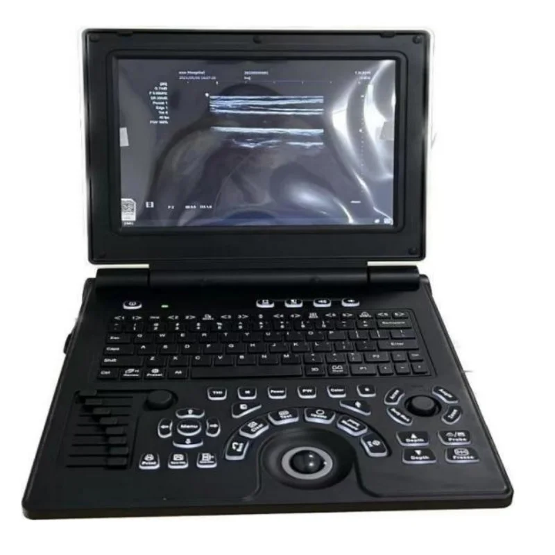 
			Escáner de ultrasonido Doppler color 20D portátil AR-K3		