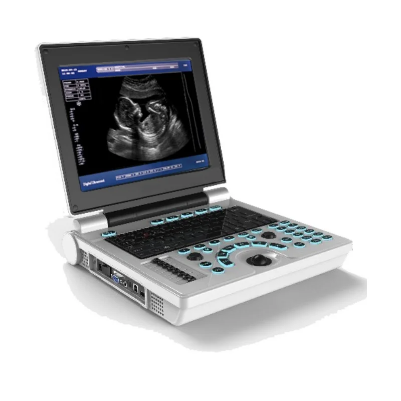 
			Escáner de ultrasonido digital portátil en blanco y negro AR-K30B ARI Equipos médicos de alta calidad		