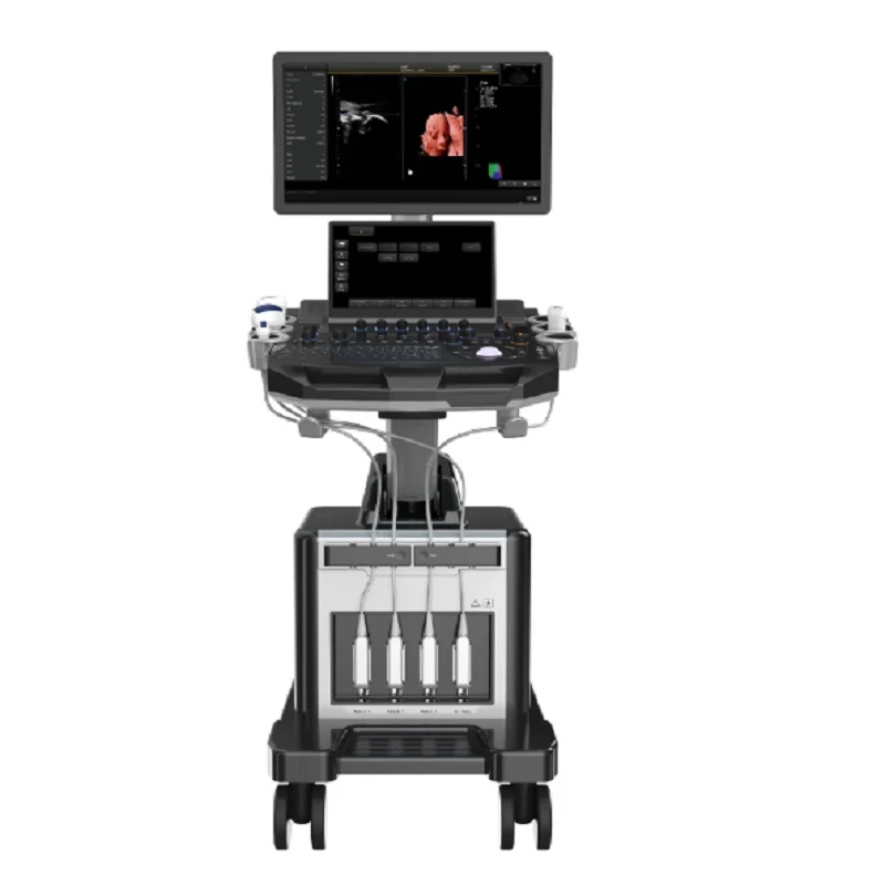 
			Escáner de ultrasonido Doppler color 7D4D con carro de doble pantalla AR-K5N		