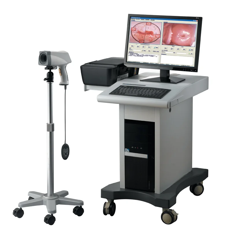 
			ARI-Colposcopio digital 2200 (conjunto completo)		