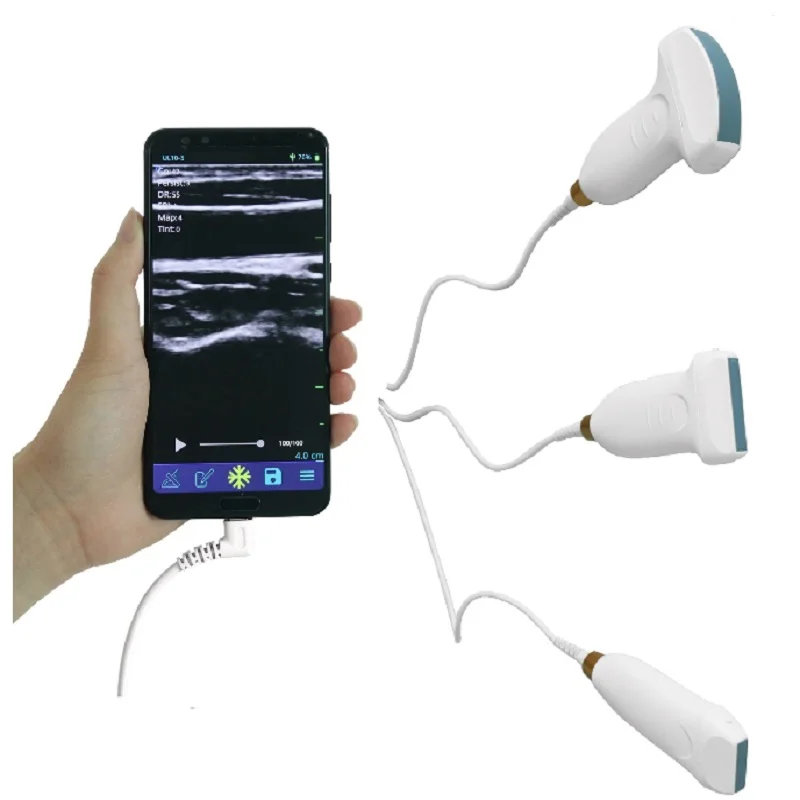 
			Escáner de ultrasonidos con sonda con cable ARI Equipos médicos de alta calidad		