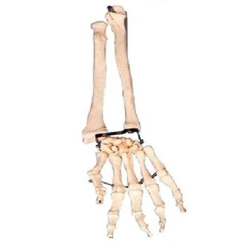 11125 Palm Bone with Elbow-Bone and Radial Bone Model
