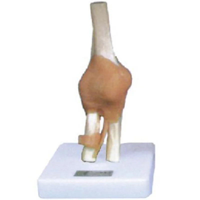 11209-5 Knee Jointwith Ligament Model