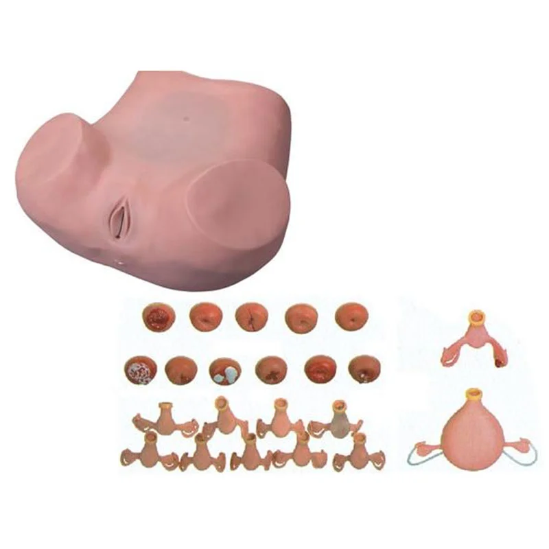 7 Gynecological Examination Model