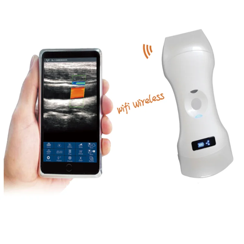 ARI-3in1 Double Head Probe Type Wireless Ultrasound Scanner