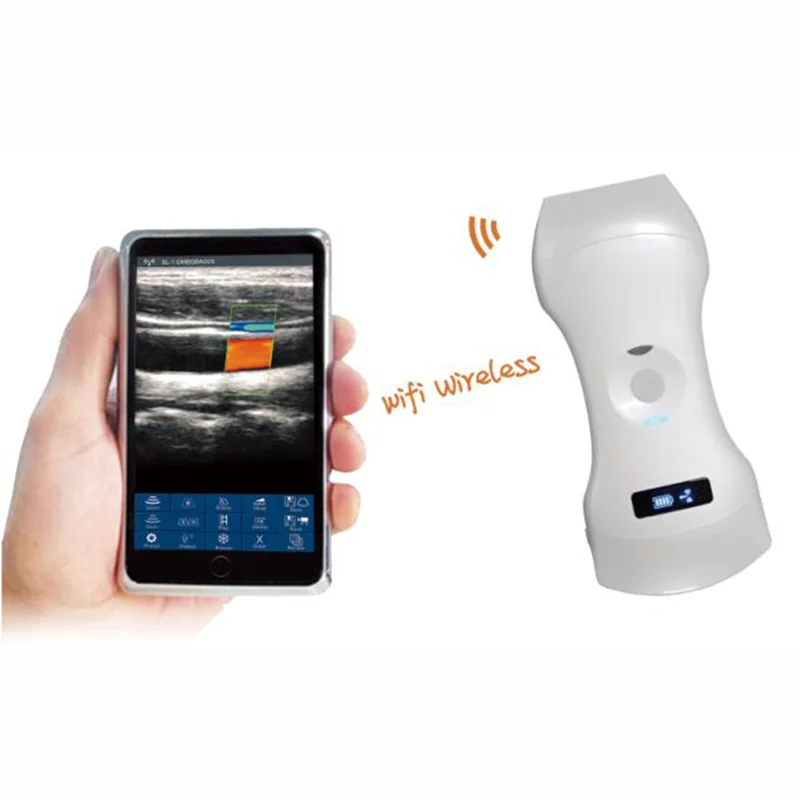 VC-3in1 Double Head Probe Type Wireless Ultrasound Scanner